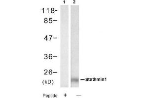 Image no. 2 for anti-Stathmin 1 (STMN1) (Ser62) antibody (ABIN319392) (Stathmin 1 抗体  (Ser62))