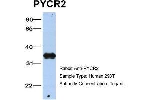Host: Rabbit Target Name: PYCR2 Sample Type: 293T Antibody Dilution: 1. (PYCR2 抗体  (C-Term))