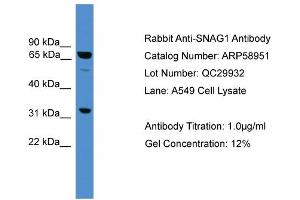 WB Suggested Anti-SNAG1  Antibody Titration: 0. (SNX18 抗体  (Middle Region))