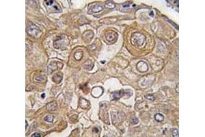 Immunohistochemistry (IHC) image for anti-Toll-Like Receptor 6 (TLR6) (AA 393-423) antibody (ABIN3029174)