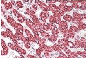 AP21283PU-N ETFB antibody staining paraffin embedded Human Liver at 3. (ETFB 抗体  (Internal Region))