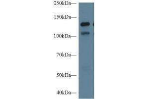 Rabbit Capture antibody from the kit in WB with Positive Control: Sample Human Hela cell lysate;. (MGEA5 ELISA 试剂盒)