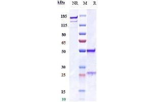Anti-MPL / TPOR / CD110 Reference Antibody (TA136) on SDS-PAGE under reducing (R) condition.