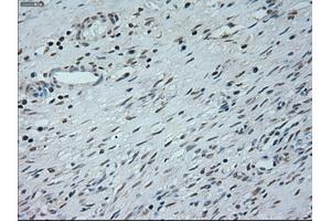 Immunohistochemical staining of paraffin-embedded Kidney tissue using anti-NEUROG1mouse monoclonal antibody. (Neurogenin 1 抗体)