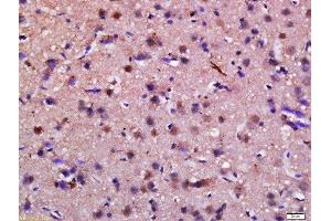 Formalin-fixed and paraffin embedded rat brain labeled with Anti-Syndetin Polyclonal Antibody, Unconjugated  at 1:200 followed by conjugation to the secondary antibody and DAB staining. (Syndetin (VPS50) (AA 3-100) 抗体)