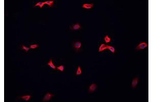 Immunofluorescence (fixed cells) (IF/ICC) image for anti-Secretoglobin, Family 2A, Member 2 (SCGB2A2) (Internal Region) antibody (ABIN6263087)