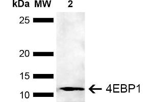 Western blot analysis of Human Embryonic kidney epithelial cell line (HEK293T) lysate showing detection of ~12. (eIF4EBP1 抗体  (AA 50-80) (PerCP))