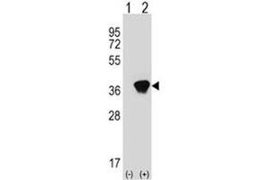 Western blot analysis of AKR1A1 antibody and 293 cell lysate (2 ug/lane) either nontransfected (Lane 1) or transiently transfected (2) with the AKR1A1 gene.