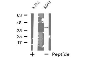 Western blot analysis of extracts from K562 cells, using MRPL3 antibody. (MRPL3 抗体  (N-Term))