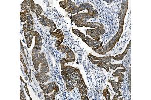IHC analysis of Cytokeratin 18 using anti-Cytokeratin 18 antibody (ABIN7600573).