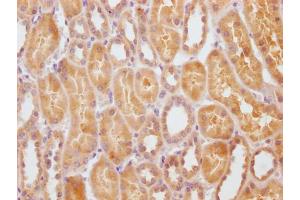 IHC image of ABIN7170717 diluted at 1:100 and staining in paraffin-embedded human kidney tissue performed on a Leica BondTM system. (STATH 抗体  (AA 20-62))