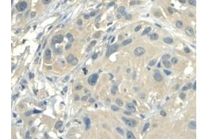 Detection of ALDH1A2 in Human Esophagus Tissue using Polyclonal Antibody to Aldehyde Dehydrogenase 1 Family, Member A2 (ALDH1A2) (ALDH1A2 抗体  (AA 1-422))
