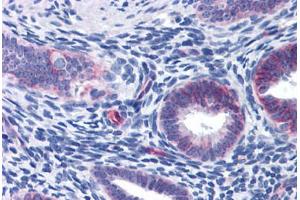 Human Uterus: Formalin-Fixed, Paraffin-Embedded (FFPE) (WDHD1 抗体  (AA 611-660))
