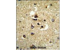 Immunohistochemistry (Paraffin-embedded Sections) (IHC (p)) image for anti-Cytochrome P450, Family 7, Subfamily B, Polypeptide 1 (CYP7B1) (AA 252-281) antibody (ABIN652732)