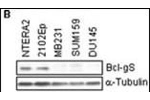 Cell lysates were subjected to Western blotting to determine the expression of Bcl-gS protein. (BCL2L14 抗体  (AA 194-229))