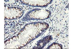 Immunohistochemical staining of paraffin-embedded Human colon tissue using anti-ACBD3 mouse monoclonal antibody. (ACBD3 抗体)