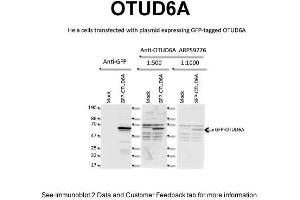 WB Suggested Anti-OTUD6A Antibody Titration: 2 ug/mlPositive Control: Human HeLa Cell line (OTUD6A 抗体  (N-Term))