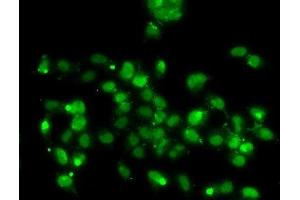 Immunofluorescence analysis of A-549 cells using WBSCR22 Polyclonal Antibody (WBSCR22 抗体)