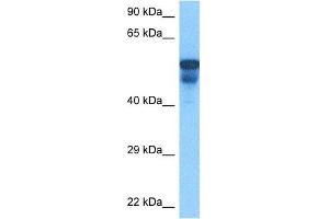 Western Blotting (WB) image for anti-Porcupine Homolog (PORCN) (N-Term) antibody (ABIN2783888)