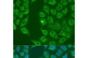 Immunofluorescence analysis of U2OS cells using HSD17B3 Polyclonal Antibody at dilution of 1:100. (HSD17B3 抗体)