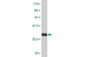 Western Blot detection against Immunogen (36. (RAB7B 抗体  (AA 100-199))