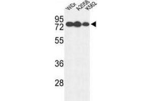 Western Blotting (WB) image for anti-Glucuronidase, beta (GUSB) antibody (ABIN3004140) (Glucuronidase beta 抗体)