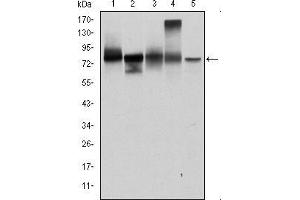 Western blot analysis using JUP mouse mAb against T47D (1), MCF-7 (2), SKBR-3 (3), A431 (4) and HEK293 (5) cell lysate. (JUP 抗体)