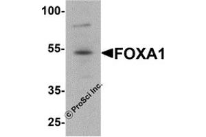 Western Blotting (WB) image for anti-Forkhead Box A1 (FOXA1) antibody (ABIN1077450) (FOXA1 抗体)