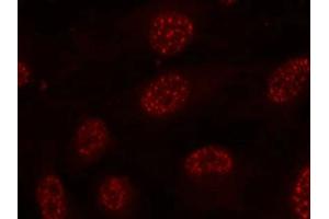 Immunofluorescence staining of methanol-fixed Hela cells using MAPKAPK-2(Phospho-Thr334) Antibody. (MAPKAP Kinase 2 抗体  (pThr334))