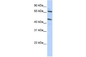 Western Blotting (WB) image for anti-Solute Carrier Family 26 (Sulfate Transporter), Member 10 (SLC26A10) antibody (ABIN2458442) (SLC26A10 抗体)