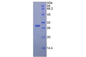 SDS-PAGE analysis of Mouse Insulin Like Growth Factor 2 Receptor (IGF2R) Protein. (IGF2R 蛋白)