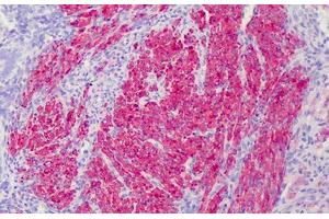 Human Myometrium: Formalin-Fixed, Paraffin-Embedded (FFPE) (Calponin 抗体  (AA 1-298))