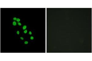 Immunofluorescence analysis of HepG2 cells, using IRX2 Antibody. (IRX2 抗体  (AA 231-280))