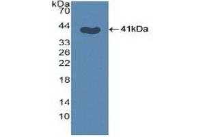 Detection of Recombinant SKP2, Human using Polyclonal Antibody to S-Phase Kinase Associated Protein 2 (SKP2) (SKP2 抗体  (AA 43-397))