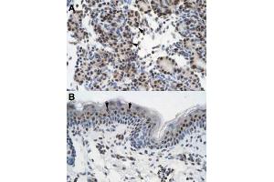 Immunohistochemical staining (Formalin-fixed paraffin-embedded sections) of human pancreas (A) and human skin (B) with GTF2I polyclonal antibody  at 4-8 ug/mL working concentration. (GTF2I 抗体  (N-Term))