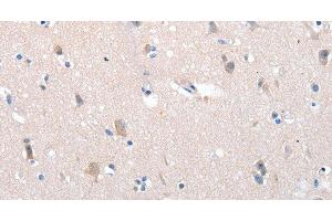 Immunohistochemistry of paraffin-embedded Human brain using YWHAG Polyclonal Antibody at dilution of 1:100 (14-3-3 gamma 抗体)