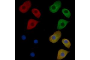 CXCR4 Mouse Monoclonal Antibody staining Hela cells by IF/ICC. (CXCR4 抗体)