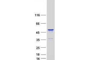 Western Blotting (WB) image for Flap Structure-Specific Endonuclease 1 (FEN1) protein (Myc-DYKDDDDK Tag) (ABIN2721006)