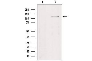 Western blot analysis of extracts from Hela, using TAOK2 Antibody.