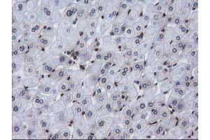 Image no. 3 for anti-CTD (Carboxy-terminal Domain, RNA Polymerase II, Polypeptide A) Small Phosphatase 1 (CTDSP1) antibody (ABIN1497679) (CTDSP1 抗体)