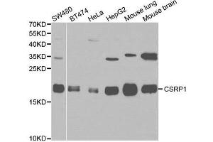 Western blot analysis of various cell lines, using CSRP1 antibody. (CSRP1 抗体)