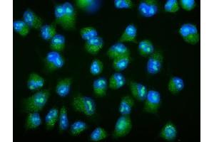 IF analysis of Galectin 2/LGALS2 using anti-Galectin 2/LGALS2 antibody (ABIN7598979).