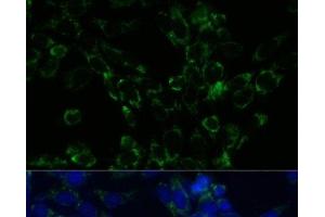 Immunofluorescence analysis of NIH-3T3 cells using GLUD1 Polyclonal Antibody at dilution of 1:100. (GLUD1 抗体)