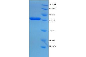 SDS-PAGE (SDS) image for Dynein, Axonemal, Light Chain 1 (DNAL1) (AA 1-89), (full length) protein (GST tag) (ABIN7479599)