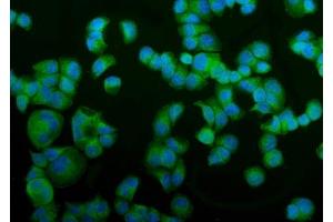 IF analysis of NSF using anti-NSF antibody (ABIN7601630). (NSF 抗体  (AA 4-636))