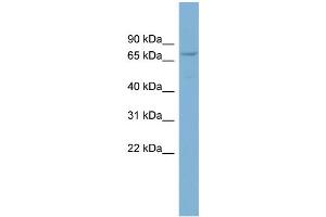 WB Suggested Anti-CNOT4 Antibody Titration: 0. (CNOT4 抗体  (Middle Region))