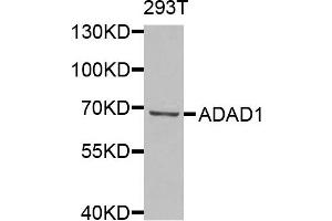 Western blot analysis of extracts of 293T cells, using ADAD1 antibody. (ADAD1 抗体)