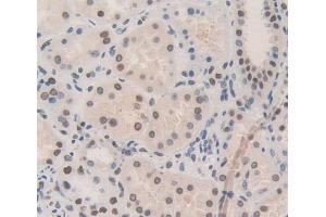Used in DAB staining on fromalin fixed paraffin- embedded Kidney tissue (NUP133 抗体  (AA 899-1091))