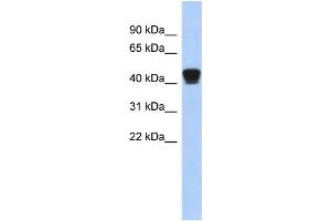 WB Suggested Anti-TXNDC4 Antibody Titration: 0. (ERP44 抗体  (Middle Region))