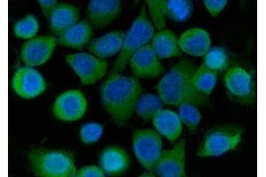 IF analysis of SRI using anti-SRI antibody (ABIN7599836). (SRI 抗体  (AA 121-161))